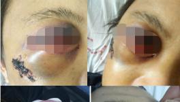 快訊 | 華潤水泥分廠發(fā)生事故?。ǜ綀D）